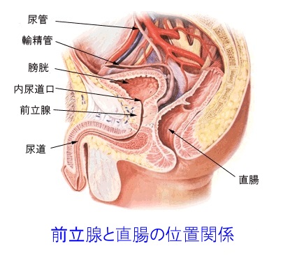 前立腺と直腸の位置関係図